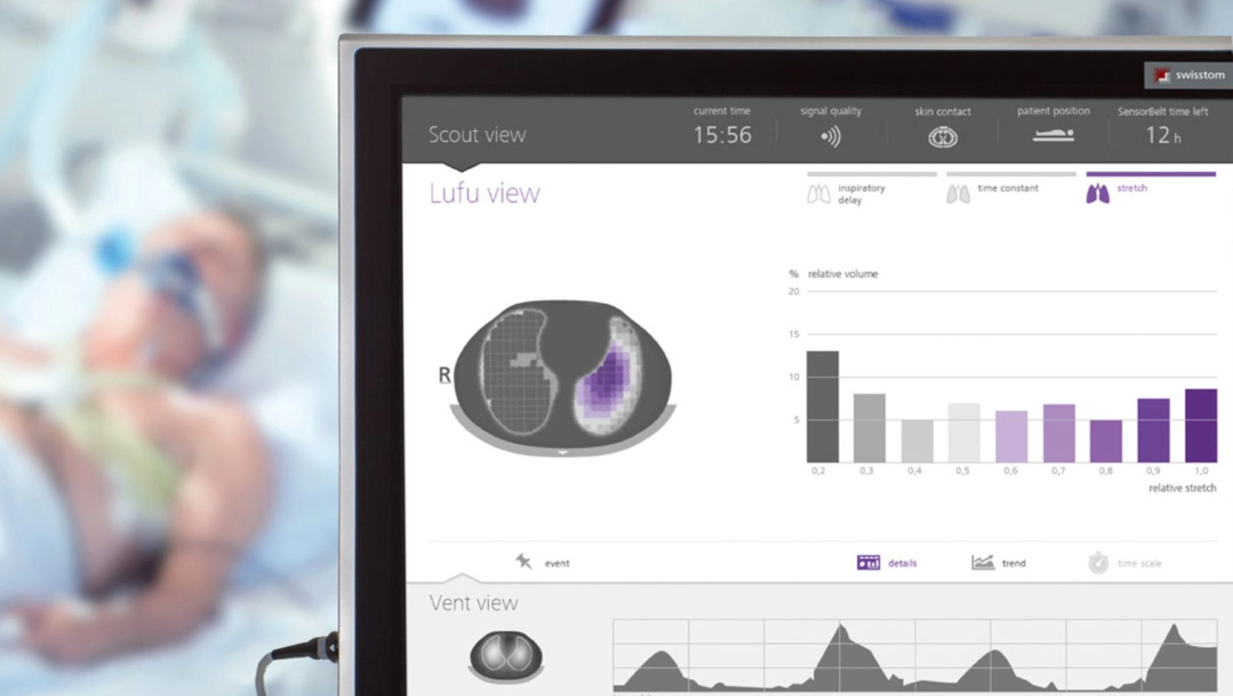 Benutzeroberfläche des Swisstom BB2 Lungenmonitors